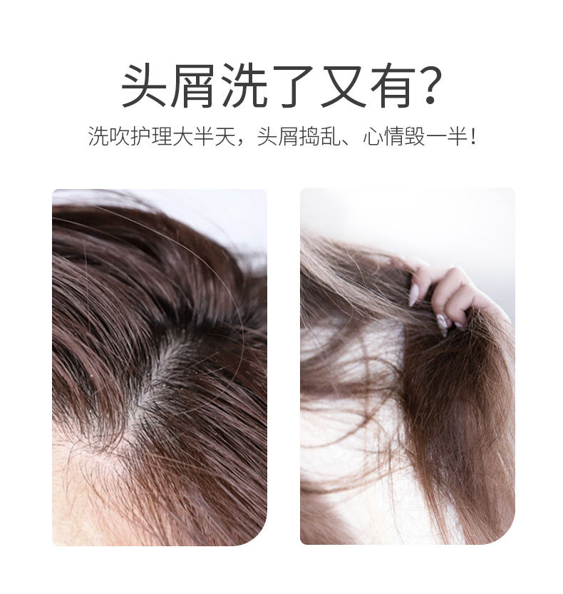 去屑舒爽_02.jpg