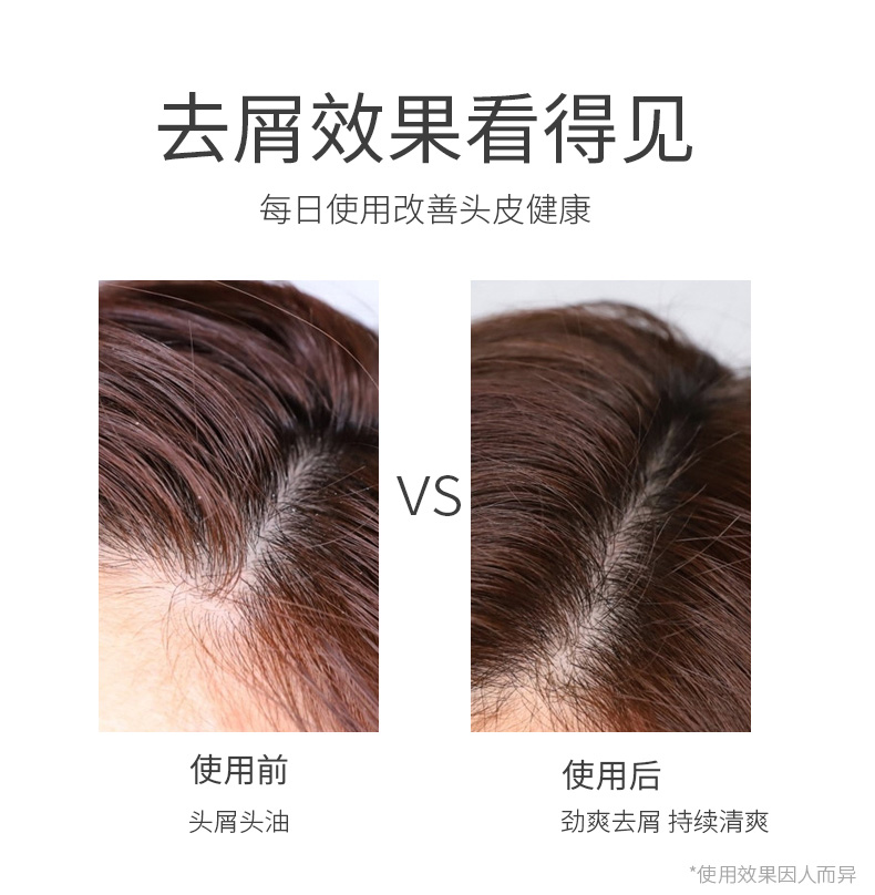去屑舒爽_08.jpg